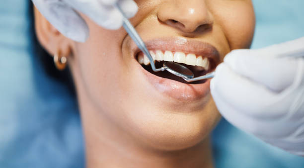 Best Emergency Dental Care for Broken or Chipped Teeth in Fairmount, IN